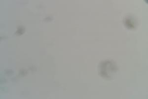 Zakopane Kasprowy Wierch Hala Gąsienicowa